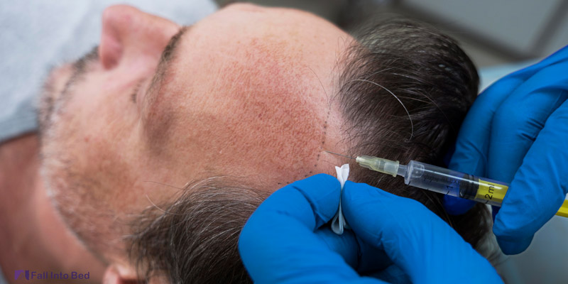 man getting hair transplant surgery